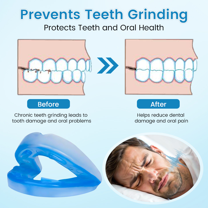 šš SILENT NIGHTS, STRONG TEETH! 𦷠QIAWI⢠Anti-Snoring Guard