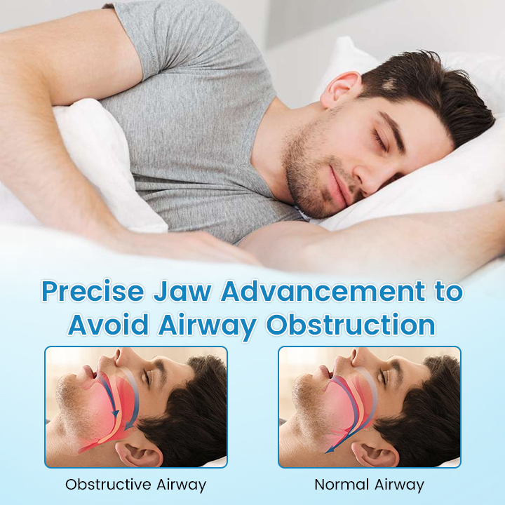 šš SILENT NIGHTS, STRONG TEETH! 𦷠QIAWI⢠Anti-Snoring Guard