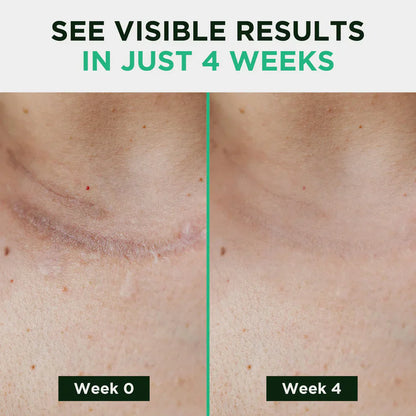 Blizkox™ ✅MEDICAL-GRADE SILICONE SCAR RECOVERY SHEETS（副本）