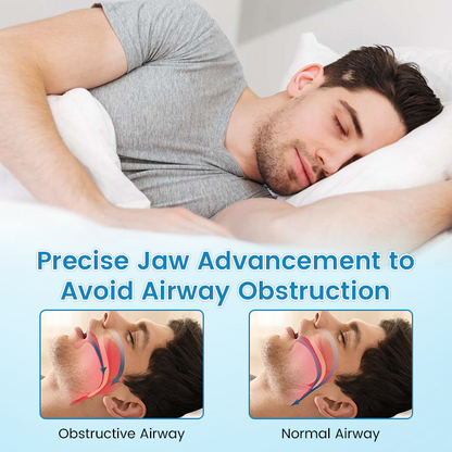 🌙🌙 SILENT NIGHTS, STRONG TEETH! 🦷 QIAWI™ Anti-Snoring Guard