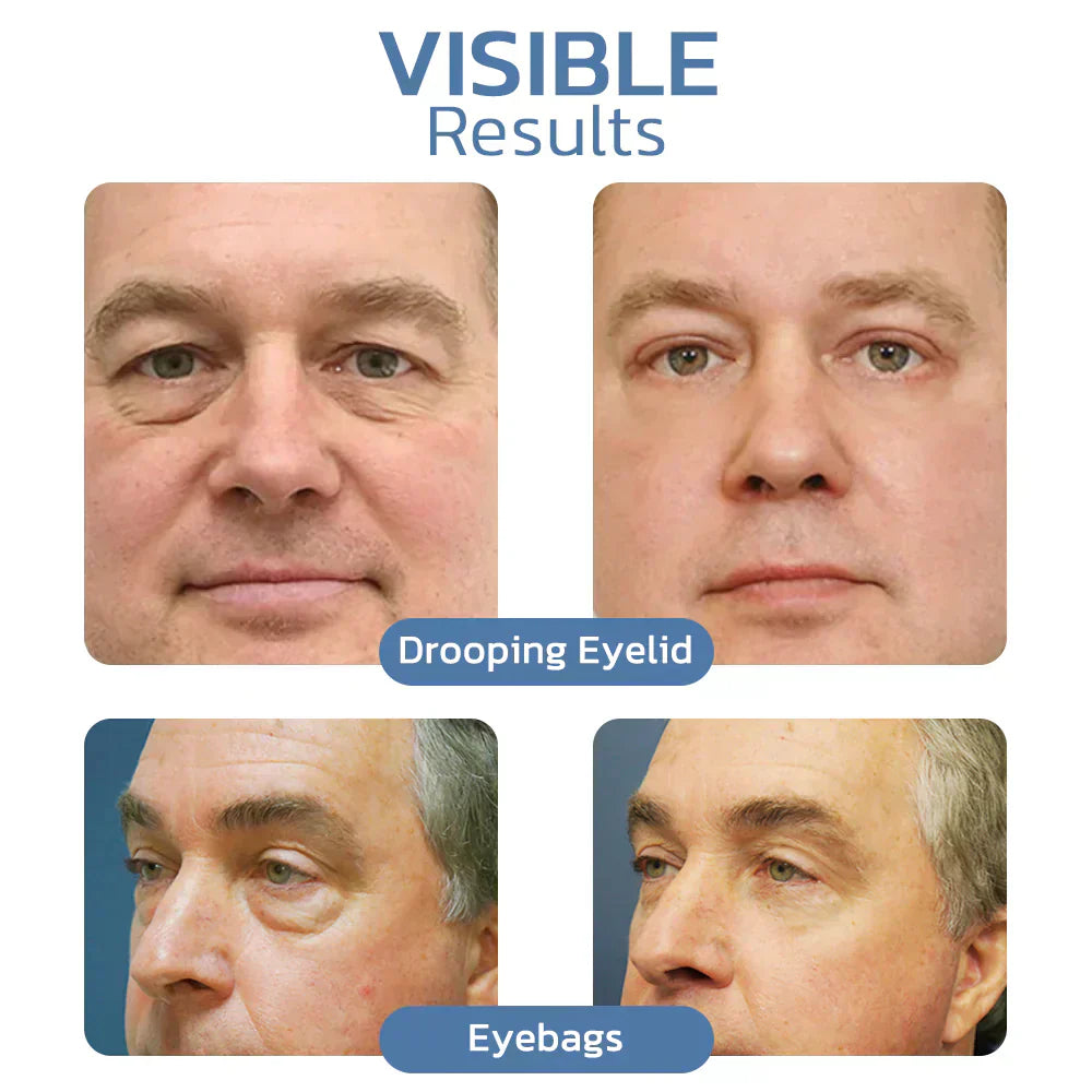💙Final Day: 82% OFF💙 LOVILDS™ Awaken Peptide Lifting Eye Gel（副本）